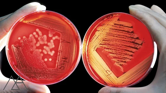 Bacterial plates